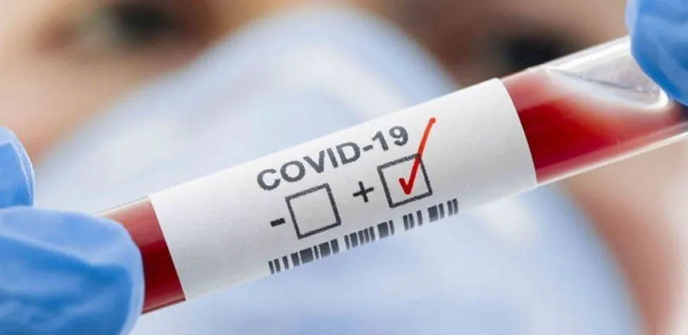 Covid-19 en Roca: ¿Se replica el aumento de casos que hay en el país? 