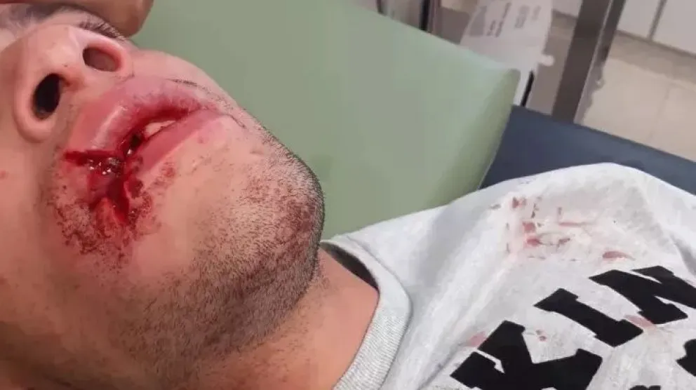 VIDEO: Tremenda agresión a una persona en Las Grutas