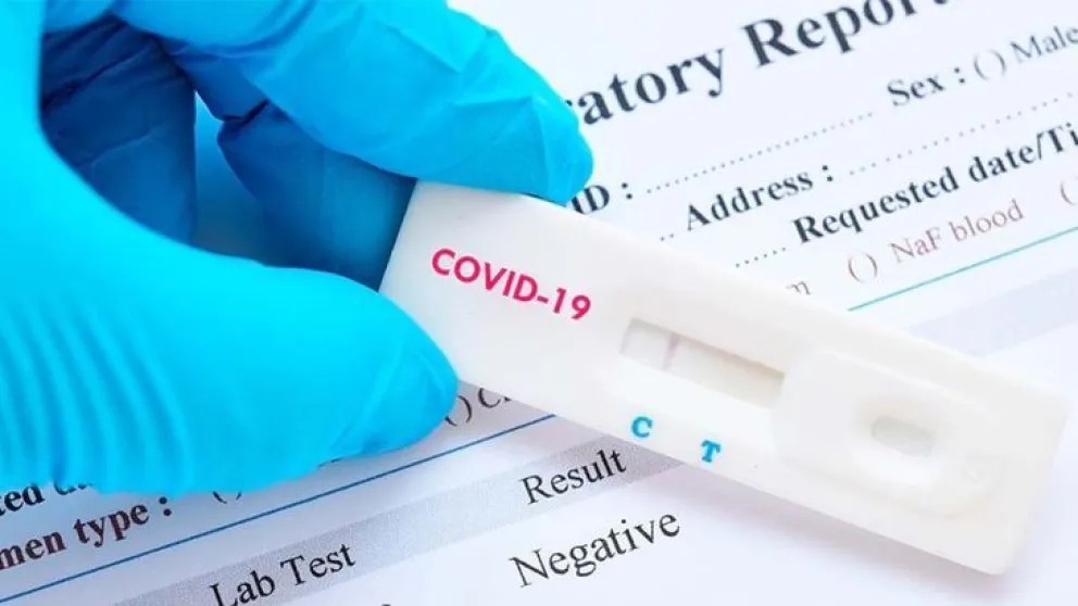 Autotest de Covid-19: Cómo es el procedimiento para utilizarlos en casa 