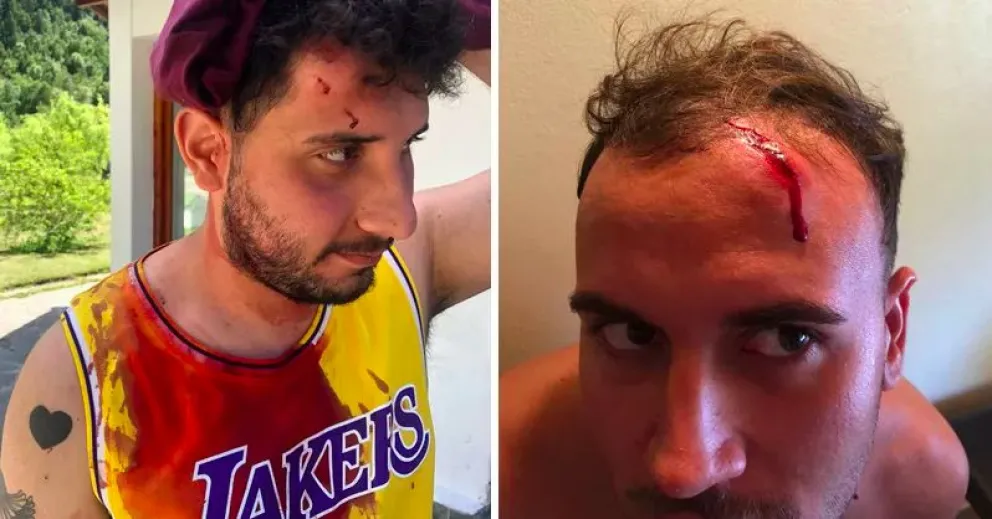 Mostraron sus heridas los turistas agredidos en el corte de la Ruta 40 