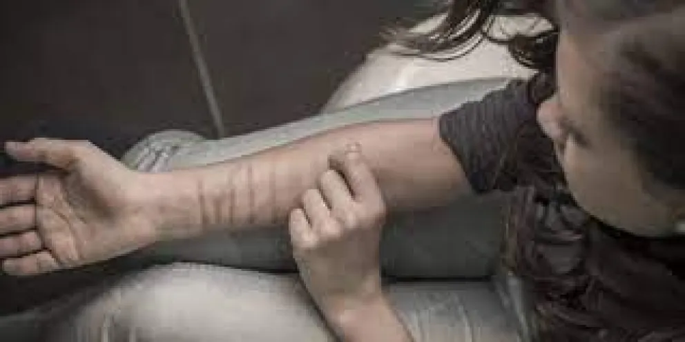 Cómo responder cuando los adolescentes se autolesionan