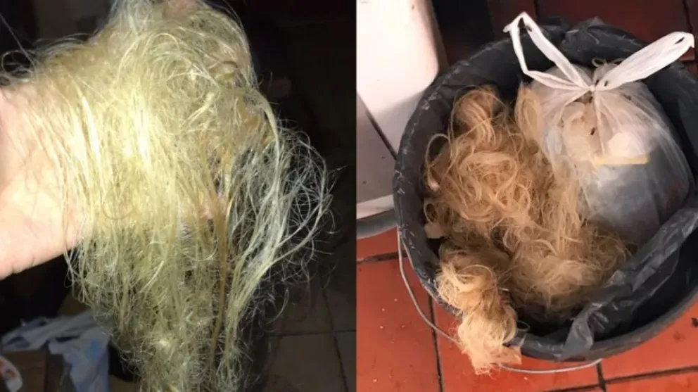 Fue a la peluquería para su fiesta de 15 y terminó pelada: “Fue negligencia”