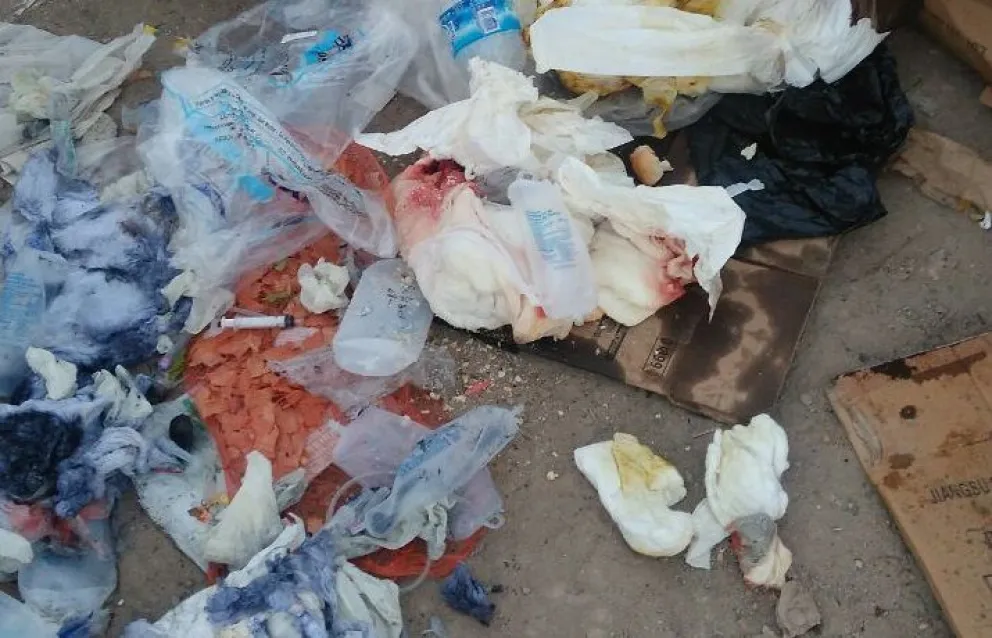 Entre los restos, hallaron una mano