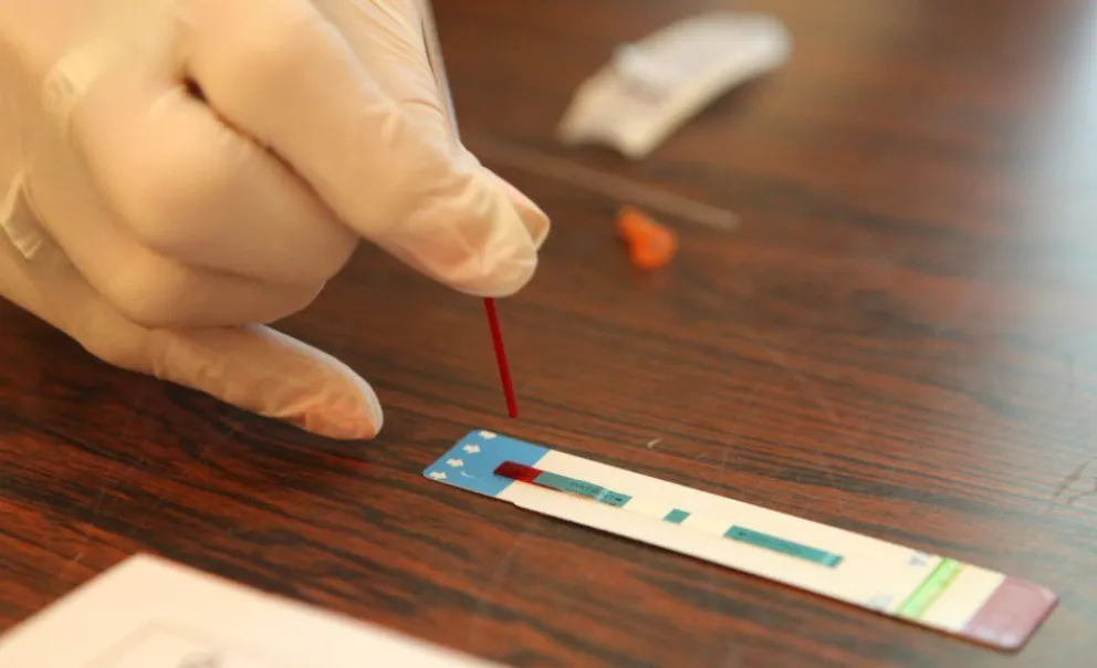 Campaña de testeo de VIH: Mirá donde podés realizar el test en Roca 