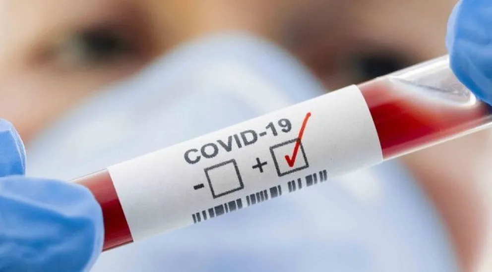 Roca es la segunda ciudad en la provincia con más casos activos de Covid-19