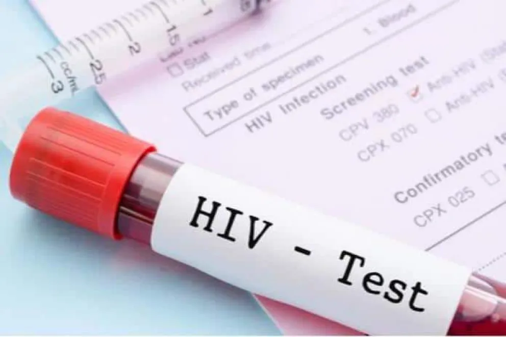 Testeos de detección de HIV gratuitos: dónde y cuándo los van a realizar?